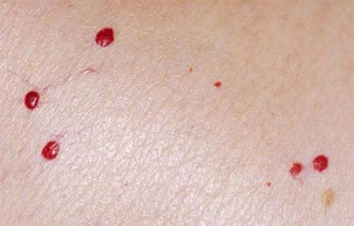 ������С�������ô���� ������С�����ô��